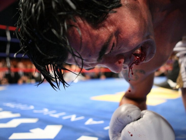 Смерть Артуро Гатти &ndash; одна из крупнейших загадок в истории бокса. Что известно спустя 13 лет?